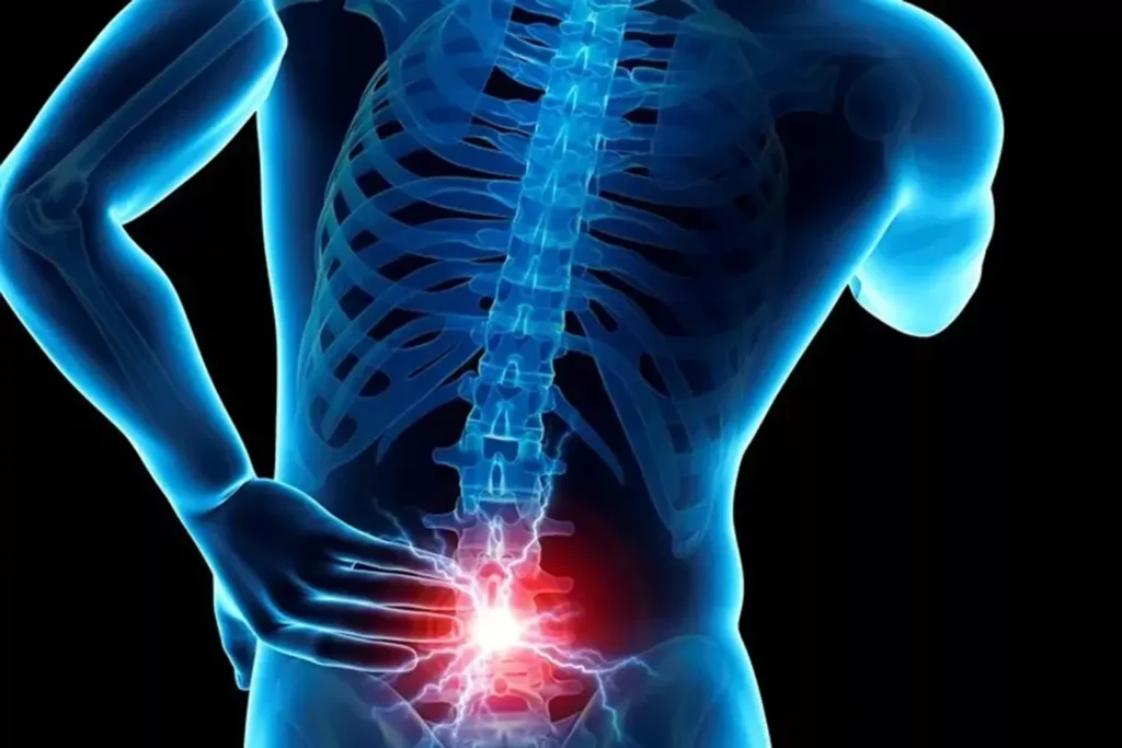 Sporcularda Mekanik Bel Ağrısı: Tanı Ve Egzersiz Yaklaşımı | Uzm.fzt. Onur Seyrek Sporcularda Mekanik Bel Ağrısı: Egzersiz Ve Tanı Rehberi