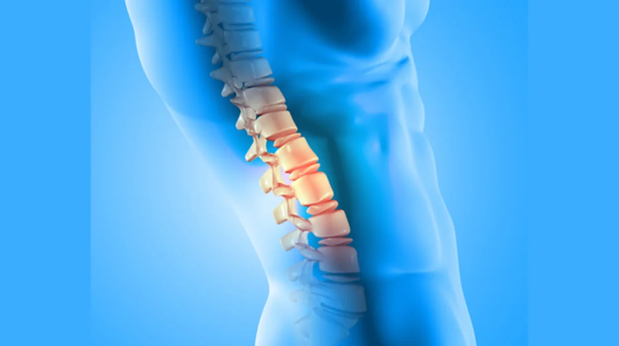 Spinal Stenoz (Kanal Daralması) Nedir? Kimlerde Görülür?