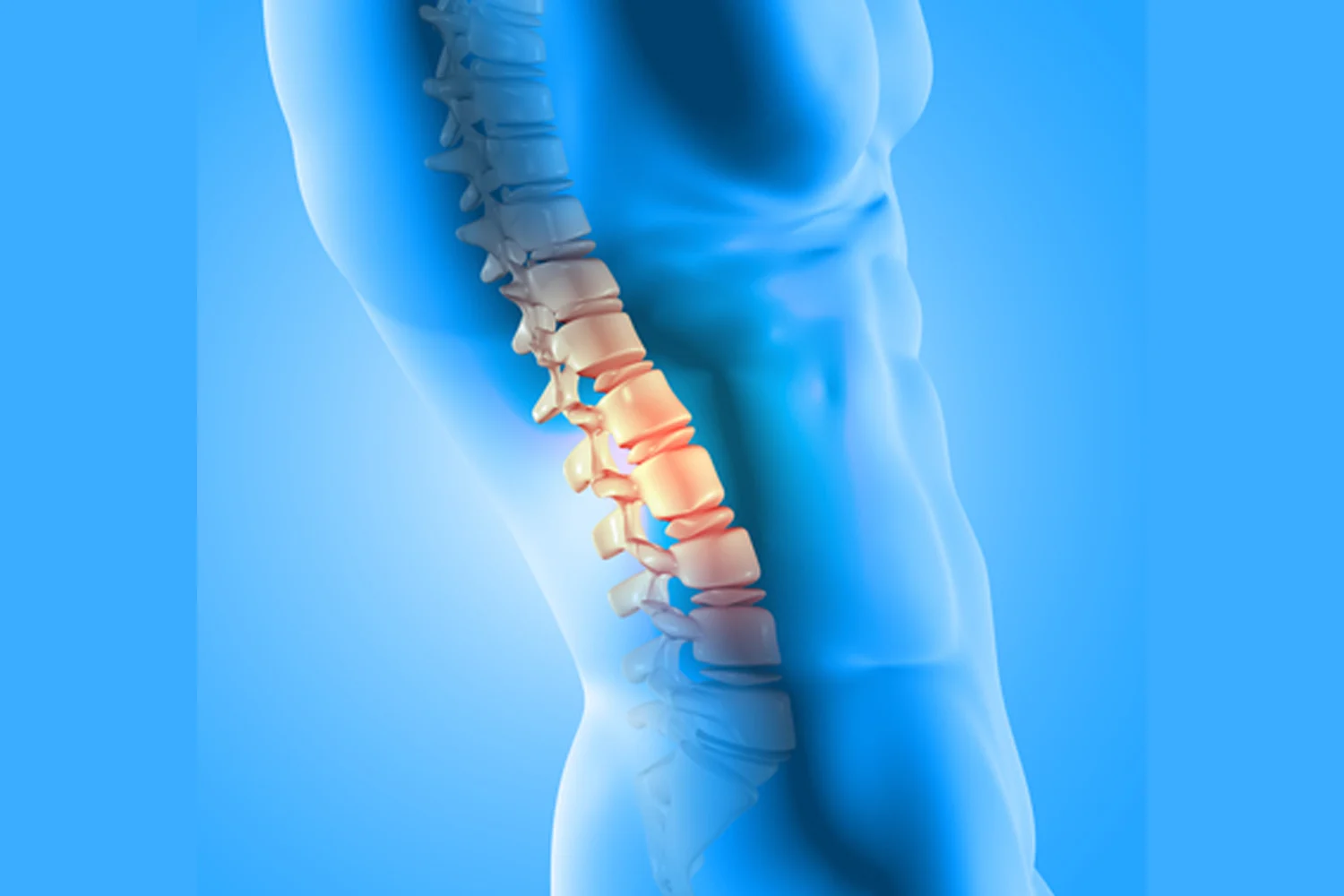 Spinal Stenoz (Kanal Daralması) Nedir? Kimlerde Görülür?