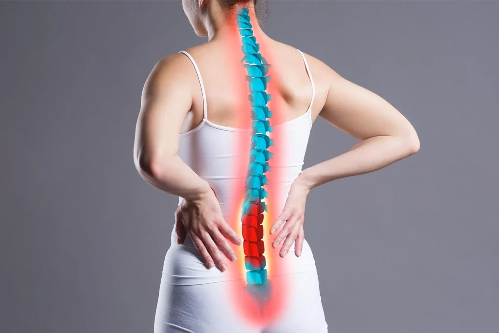 Bel Kayması (Spondilolistezis) Nedir, Belirtileri Ve Tanısı | Uzm.fzt. Onur Seyrek Bel Kayması (Spondilolistezis) Nedir, Belirtileri Ve Tanısı