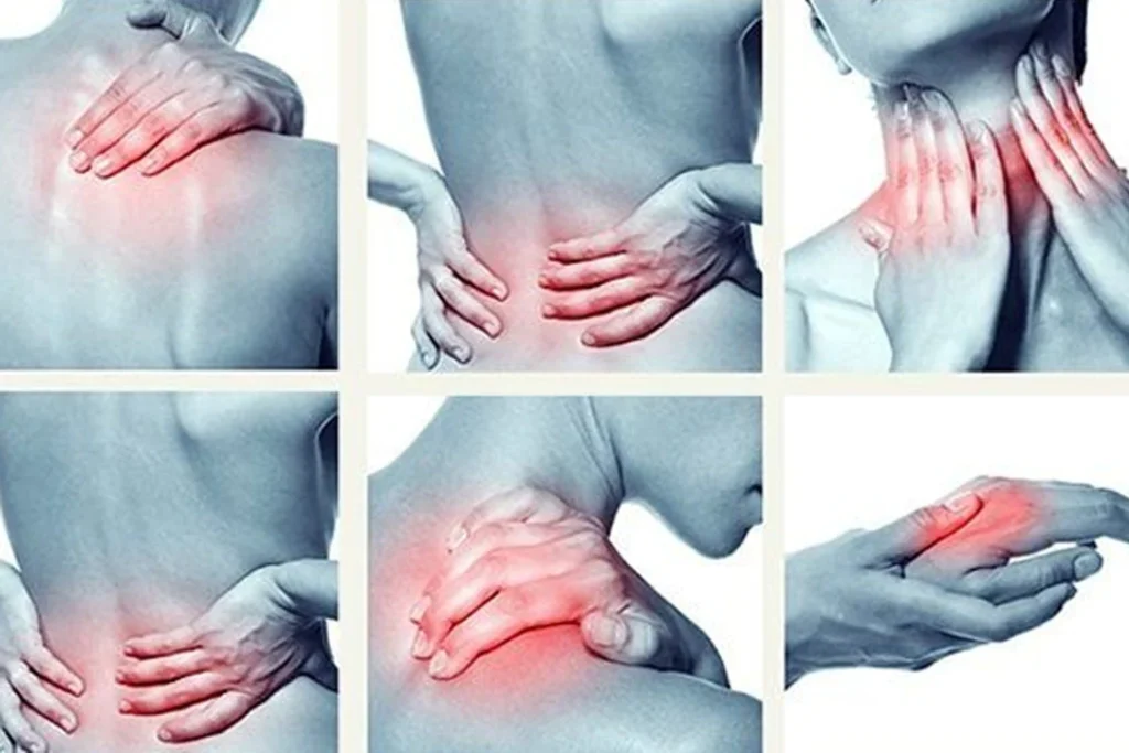Myofasiyal Ağrı Sendromu Ile Fibromyalji Arasındaki Fark Nedir? | Uzm.fzt. Onur Seyrek Myofasiyal Ağrı Sendromu Ve Fibromyalji Arasındaki Fark