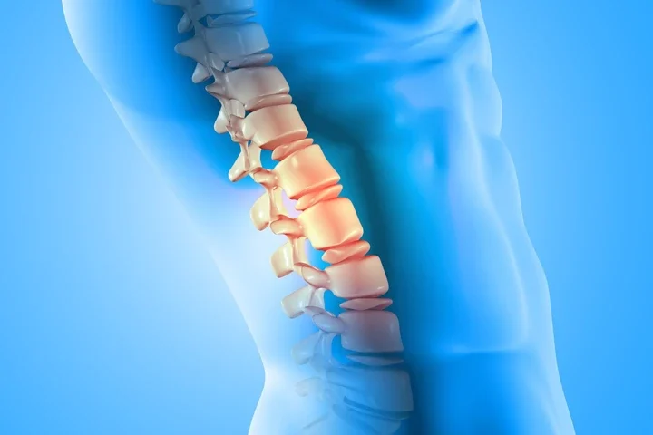 Spinal Stenozda Fizyoterapi Yöntemleri Ve Etkinliği