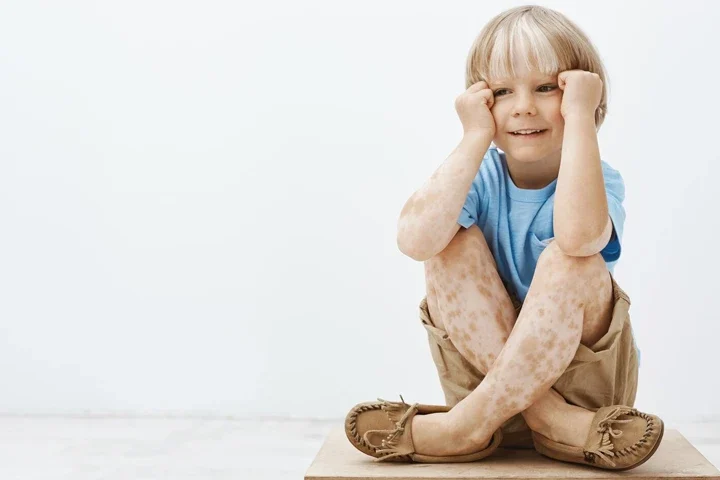 Legg-Calve-Perthes Hastalığı Çocuklarda Kalça Ağrısının Ardındaki Ciddi Neden