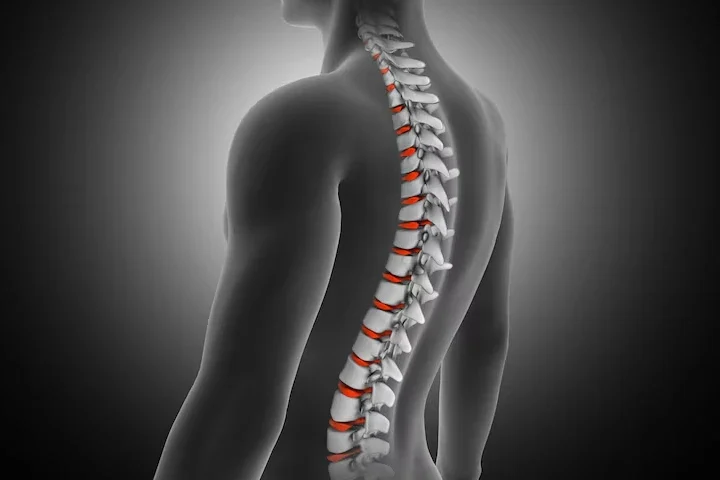 Spinal Stenoz Ve Egzersiz Ne Yapmalı, Nelerden Kaçınmalı