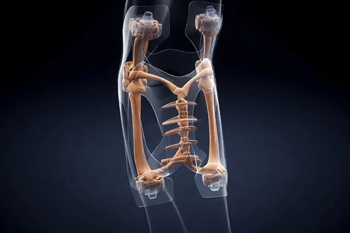 İleri Yaşta Femur Kırığı: Sadece Bir Kemik Değil, Hayatın Kırılması Ve Rehabilitasyon