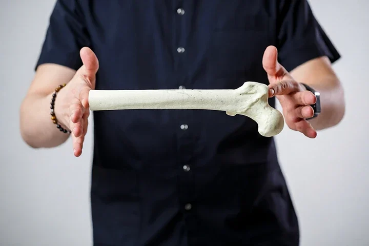 İleri Yaşta Femur Kırığı: Sadece Bir Kemik Değil, Hayatın Kırılması Ve Rehabilitasyon