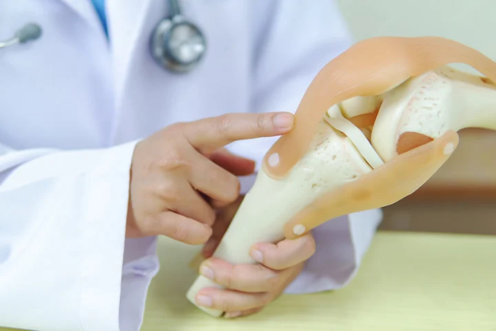 Femur Kırığı Sonrası Yürüme: Güvenli Adımlarla Hayata Dönüş Rehberi