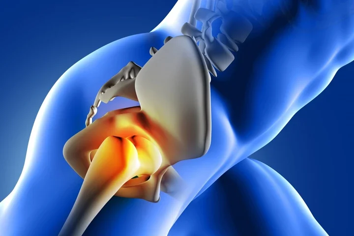 İleri Yaşta Femur Kırığı: Sadece Bir Kemik Değil, Hayatın Kırılması Ve Rehabilitasyon