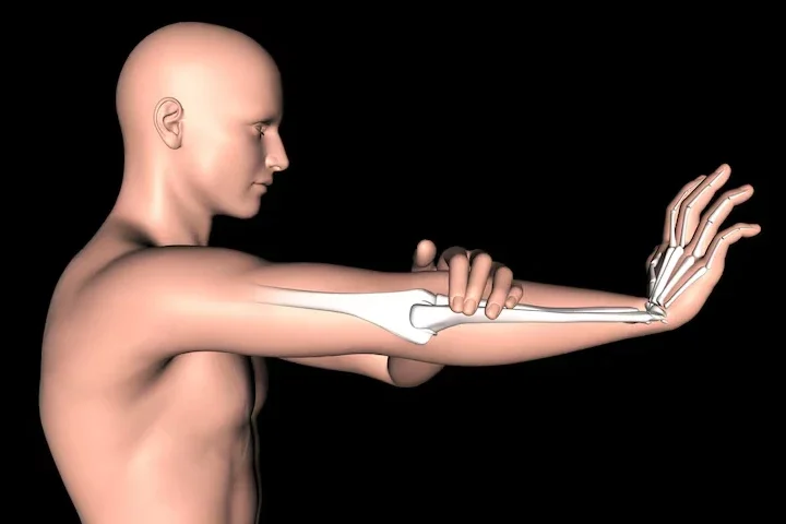 Scapholunate Ligament Yaralanmasında Ne Yapılmalı? El Bileğinin Gizli Tehlikesi