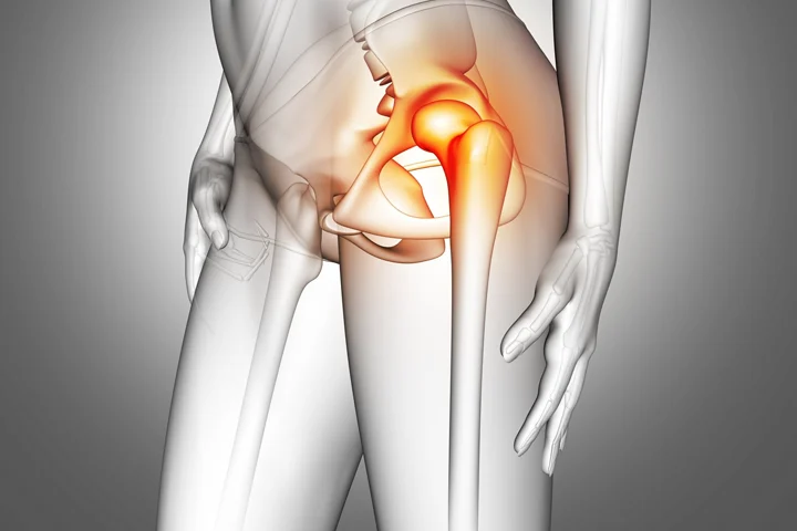 Femur Kırığı Sonrası Yürüme: Güvenli Adımlarla Hayata Dönüş Rehberi