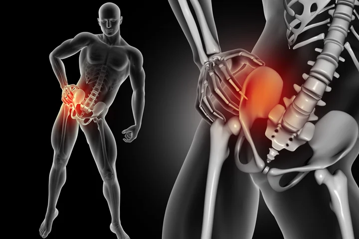 Femur Kırığı Sonrası Yürüme: Güvenli Adımlarla Hayata Dönüş Rehberi