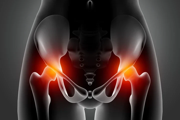 İleri Yaşta Femur Kırığı: Sadece Bir Kemik Değil, Hayatın Kırılması Ve Rehabilitasyon