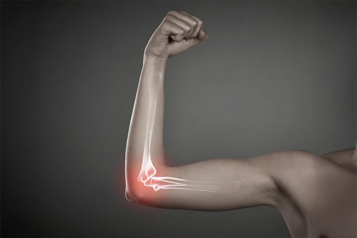 Biseps Tendonu Sorunları Sporcularda Ne Sıklıkla Görülür? Omuz Ve Dirsekteki Gizli Tehlike