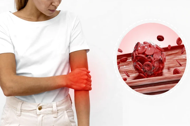 Avasküler Nekroz (Avn) Cerrahi Öncesi Ve Sonrası Rehabilitasyon Rehberi: İyileşmenin Anahtarı