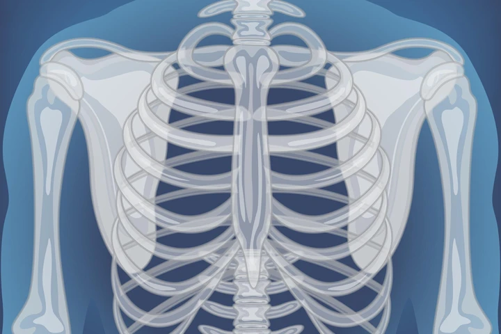 Brachial Plexus Yaralanmaları Müzisyenlerde Nasıl Ortaya Çıkar? Sahne Işıklarını Karartan Gizli Tehlike